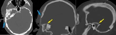 Figure 15