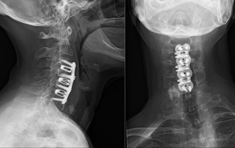 Figure 6