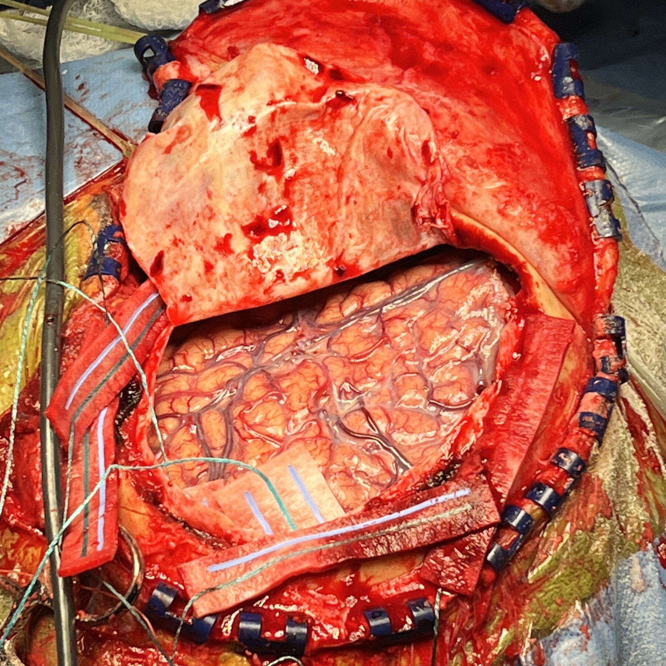 Case image