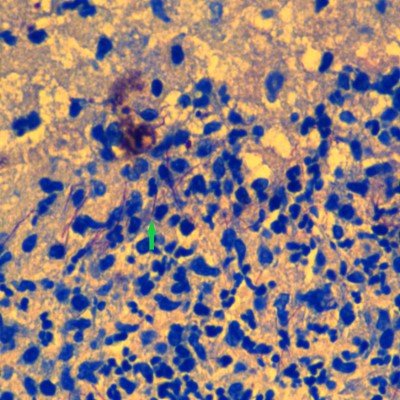 Figure 9