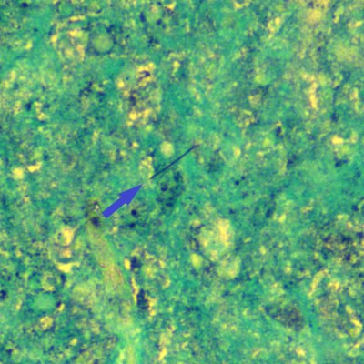 Figure 10