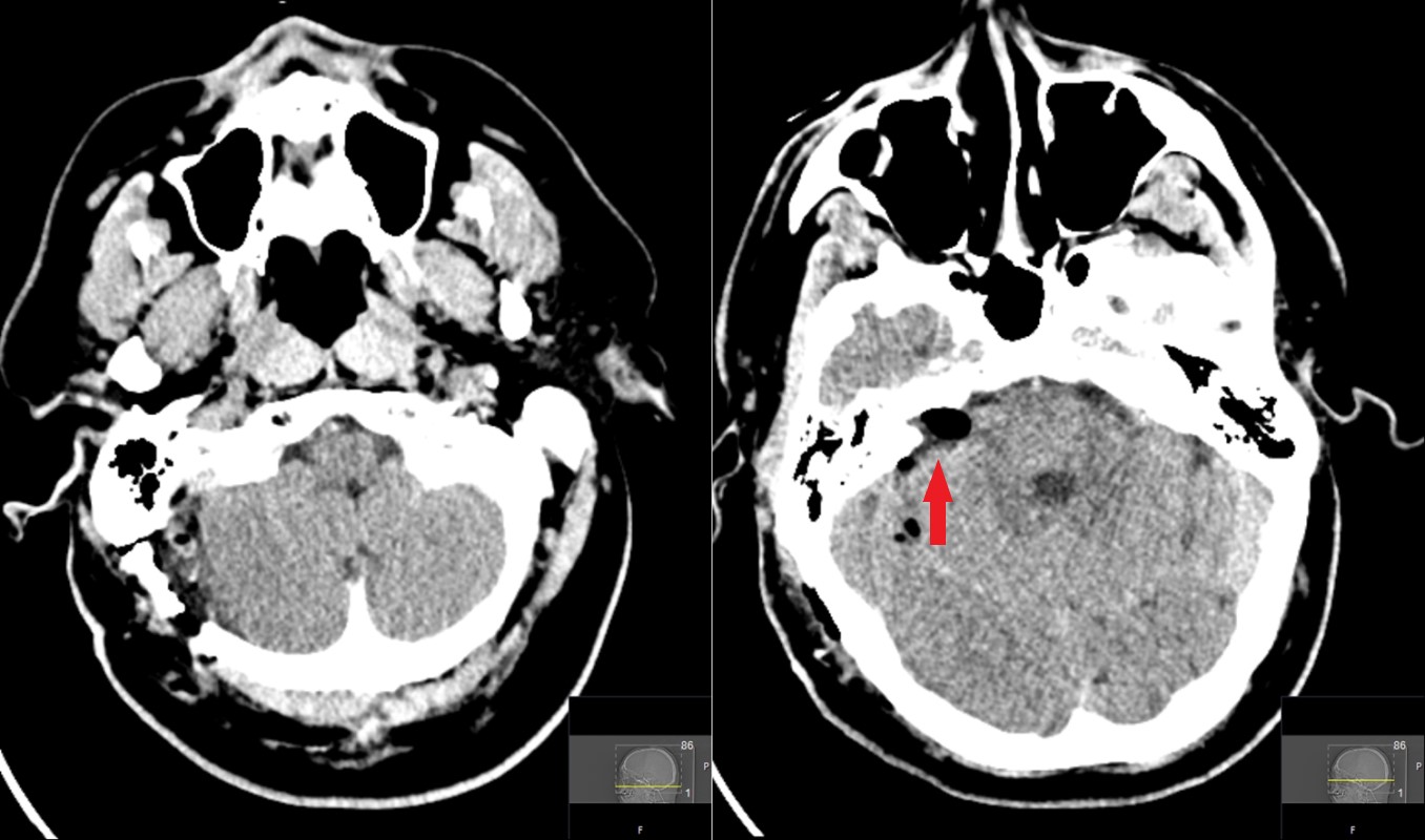 Figure 11