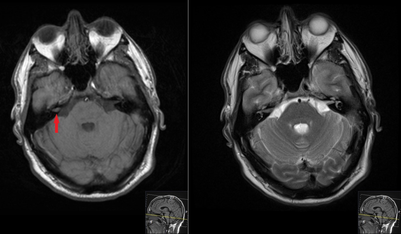 Case image
