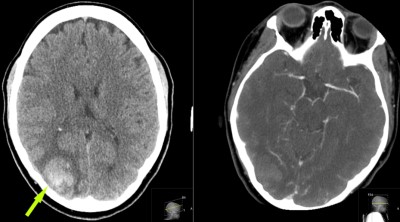 Case image